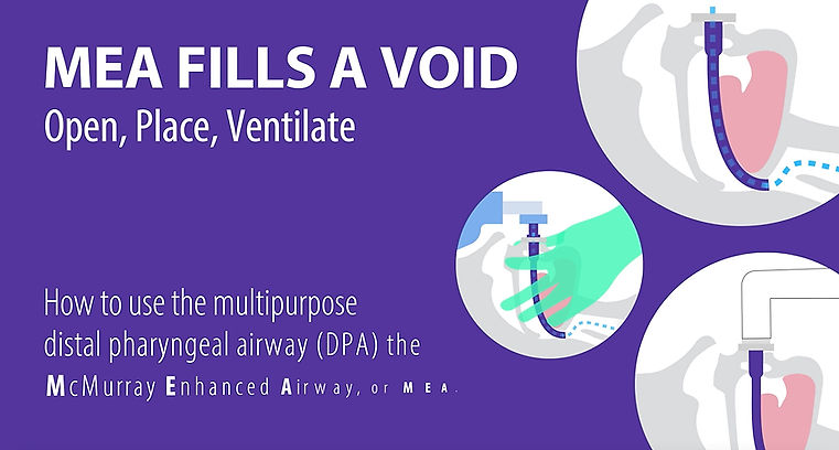 Basic Use Video for the Distal Pharyngeal Airway (DPA)